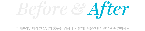 전후사례